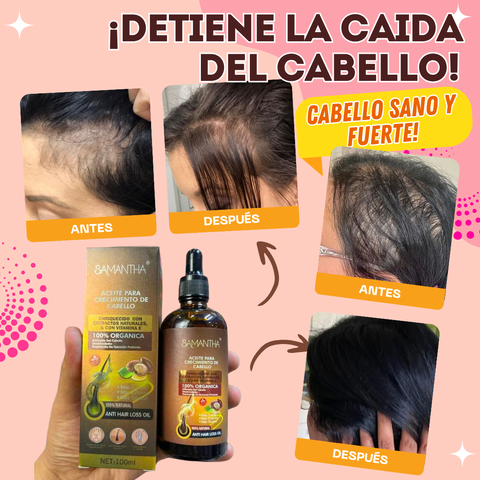 Image of 🏵️ACEITE PARA CRECIMIENTO DE CABELLO🏵️