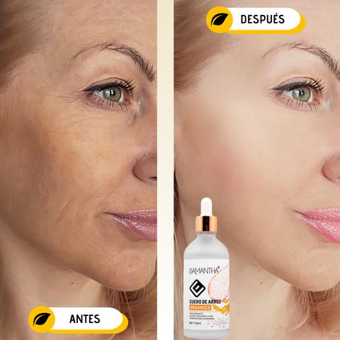 Image of 🤩SUERO DE ARROZ ORGÁNICO🤩