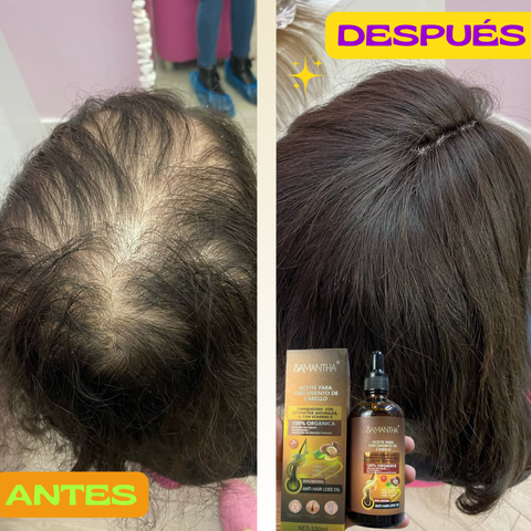 Image of 🏵️ACEITE PARA CRECIMIENTO DE CABELLO🏵️