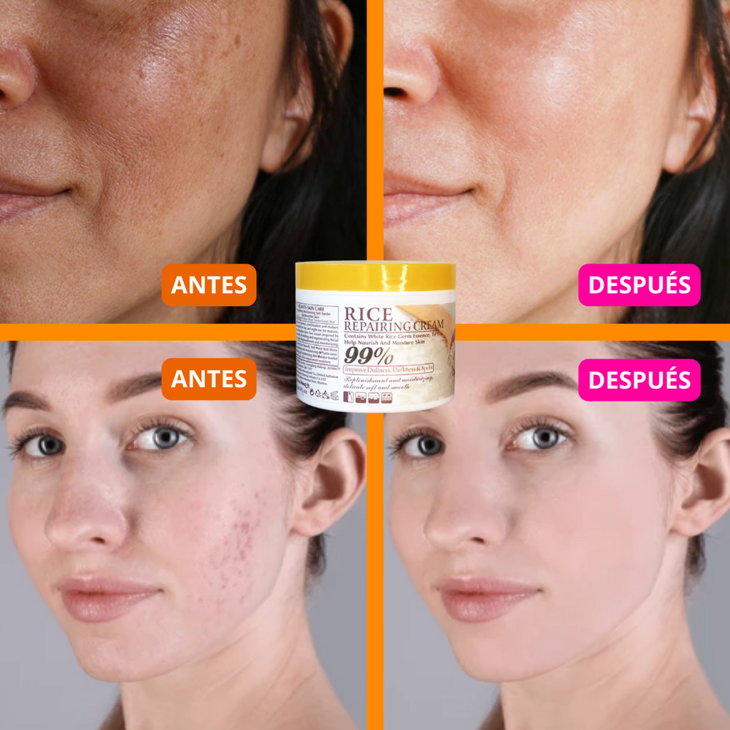 CREMA FACIAL ACLARANTE DE ARROZ