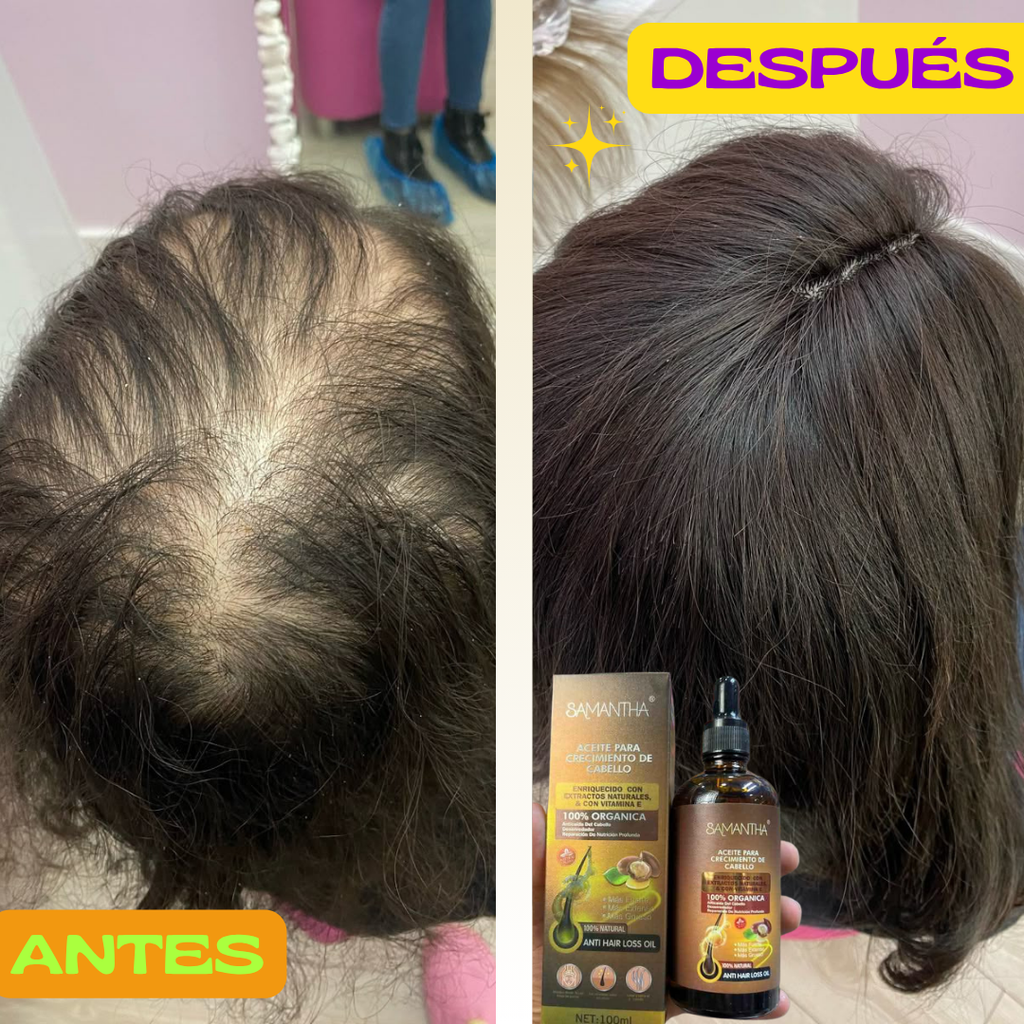 🏵️ACEITE PARA CRECIMIENTO DE CABELLO🏵️
